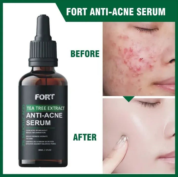 FORT Salicylic Acid Serum – Anti-Acne Face Serum & Dark Spot Correcting Serum for Glowing Skin | Acne Skin Care Products